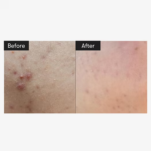 VT Reedle Shot 100 50ml – Skin Renewal & Brightening Serum