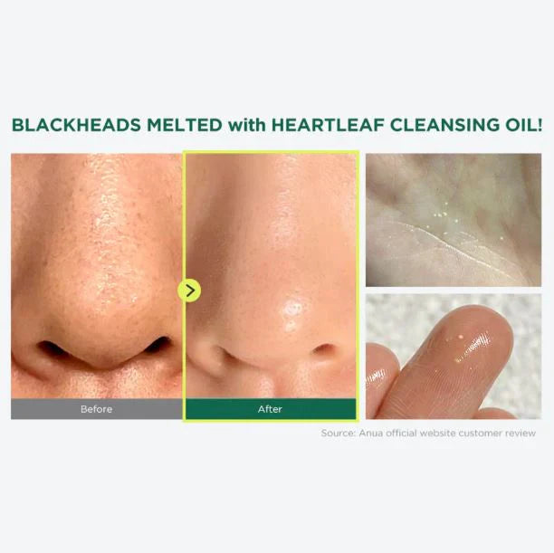 Anua Heartleaf Pore Control Cleansing Oil Mild - 200ml | Gentle Makeup Remover & Pore Care