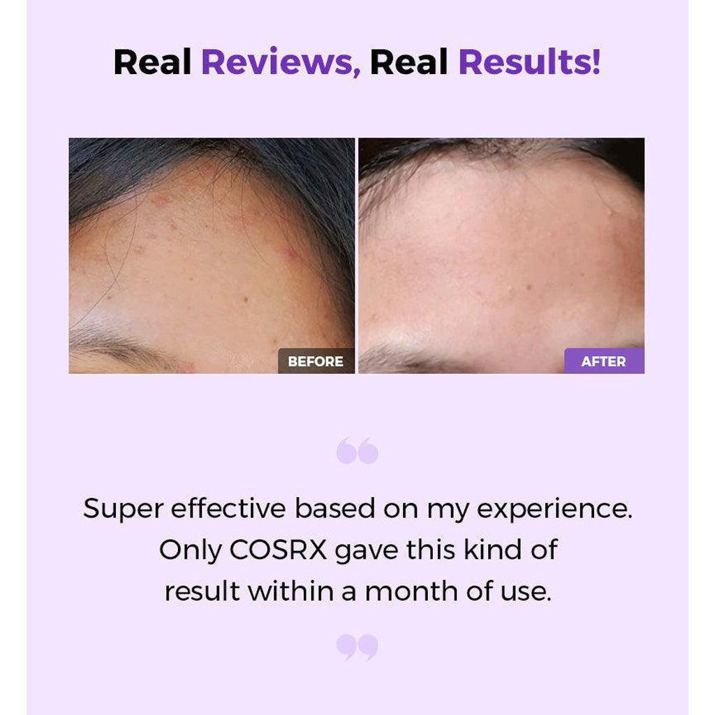 COSRX AHA BHA Clarifying Treatment Toner 200ml – Exfoliating & Hydrating Toner for Smooth, Clear Skin